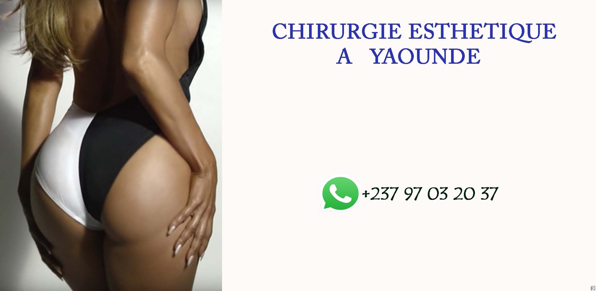 Main image of chirurgie esthétique au Cameroun