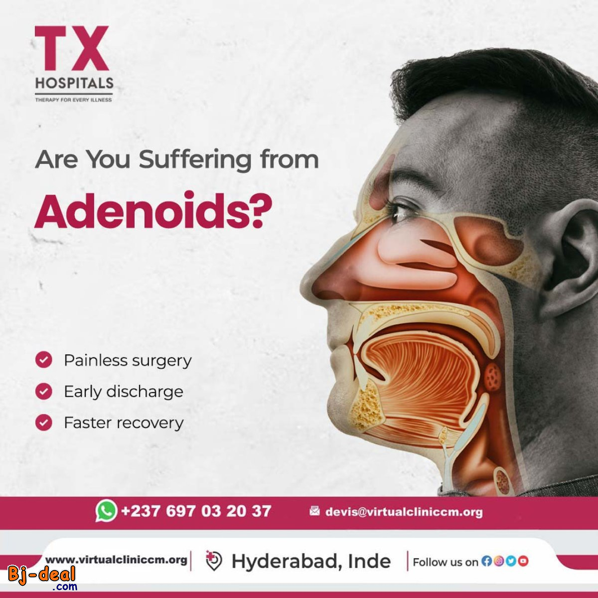 Image principale de Are you suffering from Adenoids
