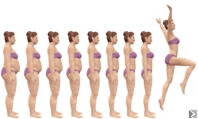 Image principale de Bypass gastrique