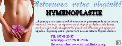 Image principale de HYMÉNOPLASTIE (CHIRURGIE DE Lâ€™HYMEN)