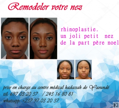 Image principale de retoucher le nez