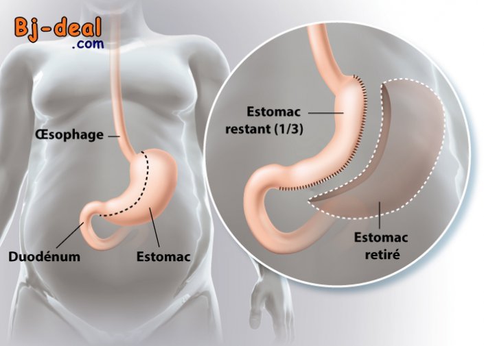 Image principale de Et si vous disiez adieu aux kilos en trop sans passer par des régimes
