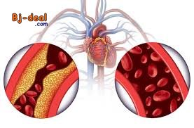 Image principale de Hypertension Reprenez le contrôle de votre vie avec Virtual Clinic