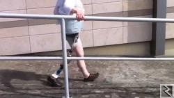 Main image of Prothèse de la jambe après amputation