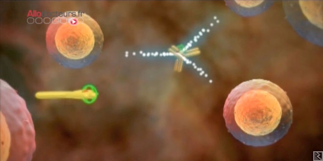 Main image of Traitement chirurgie du cancer et chimiothérapie