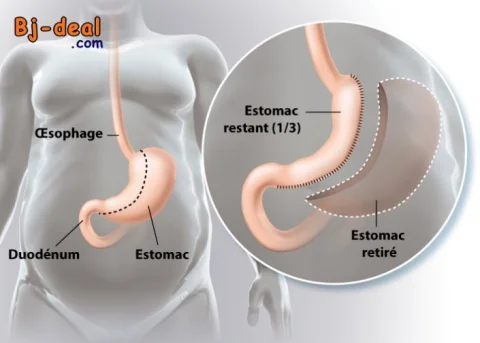 Image principale — Et si vous disiez adieu aux kilos en trop sans passer par des régimes